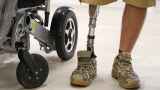 Россия утроила закупки протезов из-за массового появления инвалидов на фронте